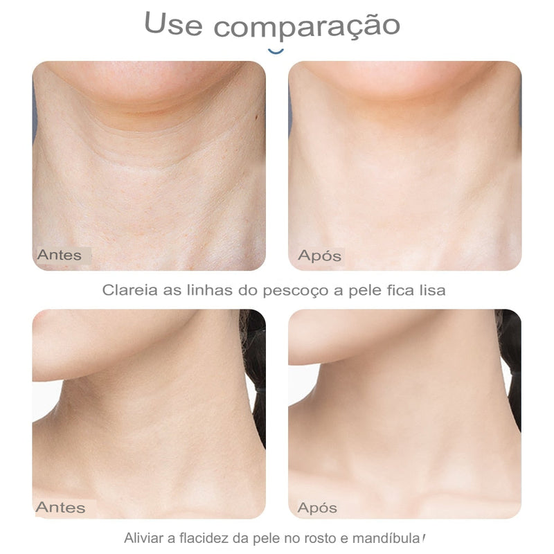 Rejuvenescedor Facial Iônico- Smart Pro